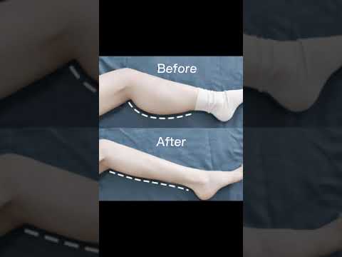 Person frustrated with weight loss despite healthy habits