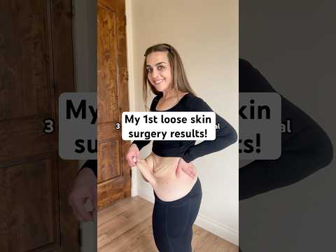 Person reflecting on their weight loss and recovery journey with a calm, motivational tone