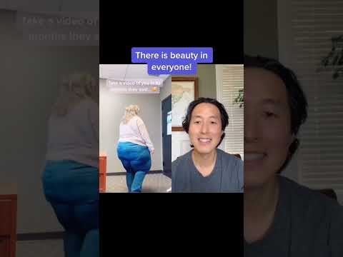 Incredible Weight Loss Journey | Real Transformation & Motivation